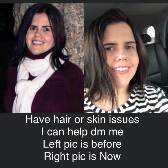 Meet your Posher, Roxanne - Picture 4 of 7